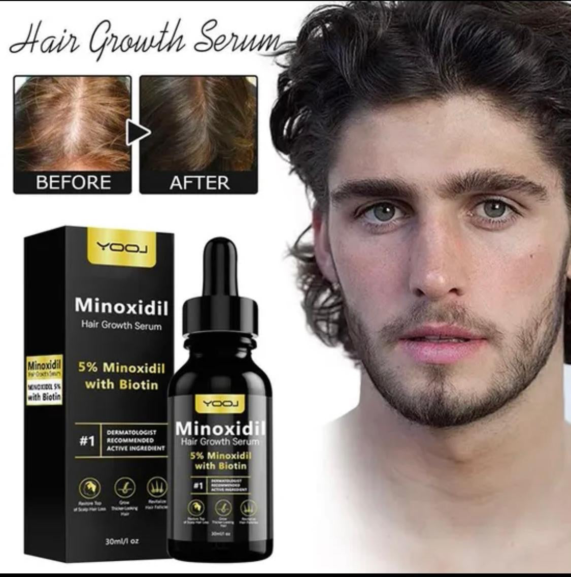 Minoxidil 5% hair serum