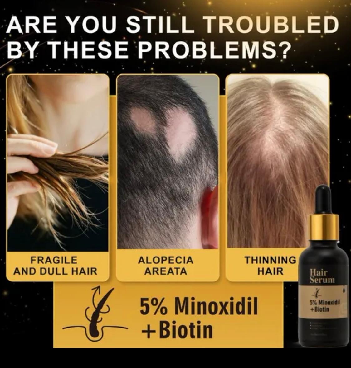 Minoxidil 5% hair serum